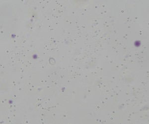 细菌三星型