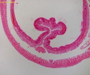 Earthworm (crosssection)