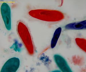 Paramecium (whole mount)