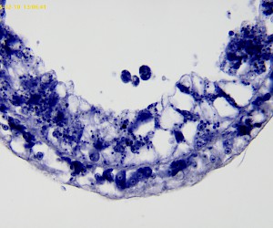 Hydra (cross section)