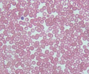 Human Blood Smear