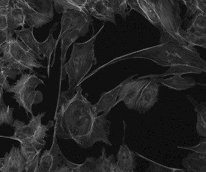 Green Fluorescent Image