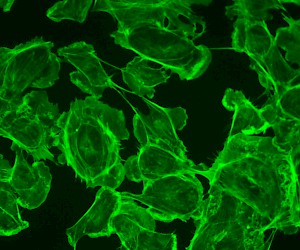 Green Fluorescent Image
