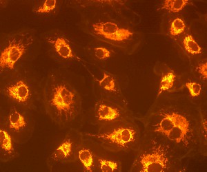Red Fluorescent Image