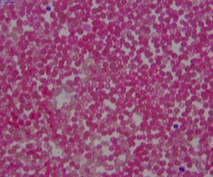 Human Blood Smear