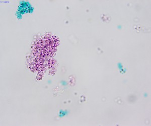 Yeast Smear