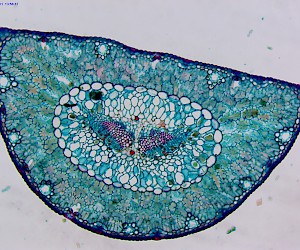 松属大孢子叶球纵切图图片
