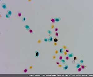 Pine Mature Pollen Grain