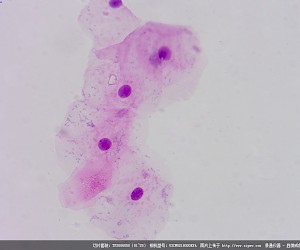 Squamous Epithelial from Human Mouth Scrapings