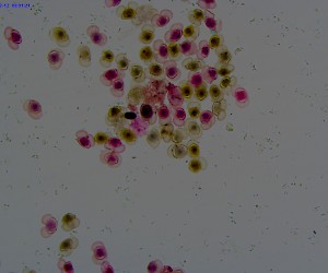 Pine Mature Pollen Grain