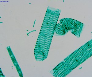 Spirogyra W.M.