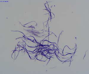 Smooth Muscle Breakaway W.M.