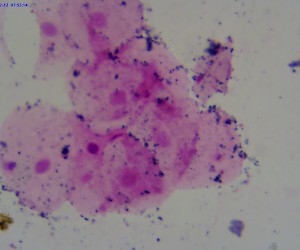 Squamous Epithelial from Human Mouth Scrapings