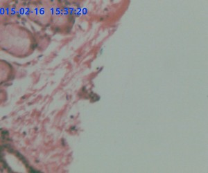 Stratified Spuamous Epithelium. Sec.