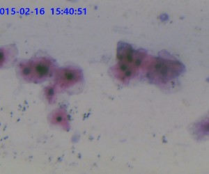 Epithelia Cell. W.M