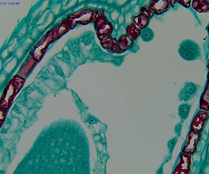 Capsella Young Embryo. Sec.