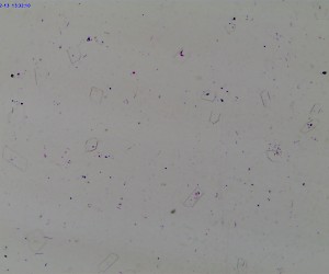 Bacteria Three Types Smear