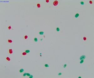 Chlamydomonas. W.M.