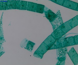 Spirogyra. W.M.