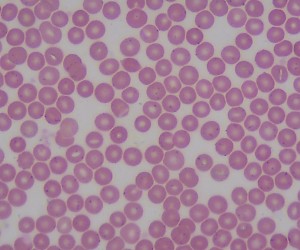 Human Blood. Smear