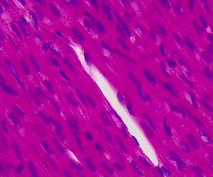 Cardiac Muscle . Human . Sec.